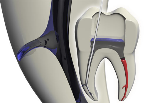 molar phys ultraschall