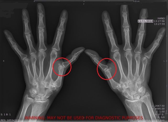 Hand