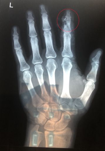 Hand2 copy